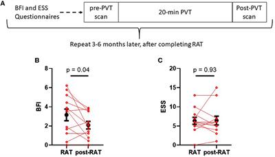 Increased posterior cingulate cortex blood flow in cancer-related fatigue